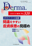 Monthly Book Derma. (デルマ ) No.320 (2022年4月増刊号)