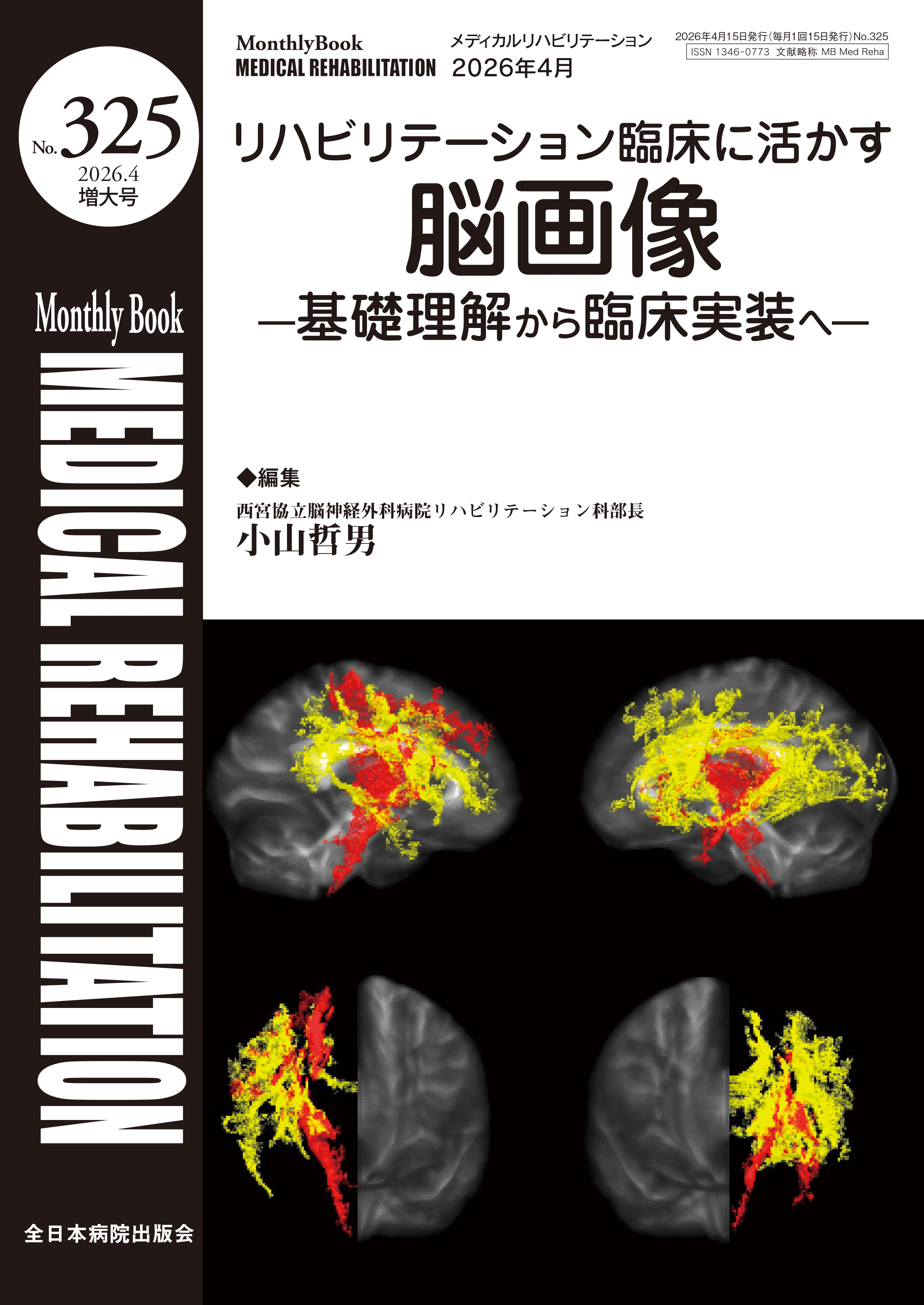 Monthly Book Medical Rehabilitation (メディカルリハビリテーション) No.325 (2026年4月増大号)