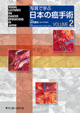 写真で学ぶ日本の癌手術　vol.2