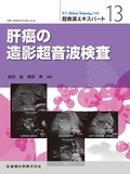 「Medical Technology」別冊 超音波エキスパート13 肝癌の造影超音波検査