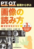 理学療法士・作業療法士　PT・OT基礎から学ぶ 画像の読み方 第3版　国試画像問題攻略