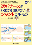 透析ナースがいまさら聞けないシャントのギモン