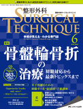 整形外科 SURGICAL TECHNIQUE（サージカルテクニック） 2019年6号