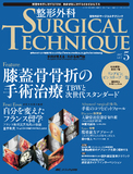 整形外科 SURGICAL TECHNIQUE（サージカルテクニック） 2017年5号