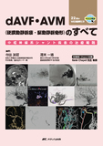 dAVF・AVM（硬膜動静脈瘻・脳動静脈奇形）のすべて