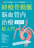 経橈骨動脈脳血管内治療（TRN）超入門