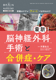 最新!脳神経外科手術と合併症・ケア