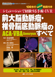 前大脳動脈瘤・椎骨脳底動脈瘤（ACA・VBA Aneurysm）のすべて