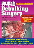 卵巣癌Debulking Surgery