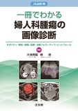 一冊でわかる婦人科腫瘍の画像診断