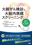 大腸がん検診と大腸内視鏡スクリーニング