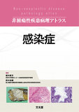 感染症
