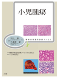 小児腫瘍