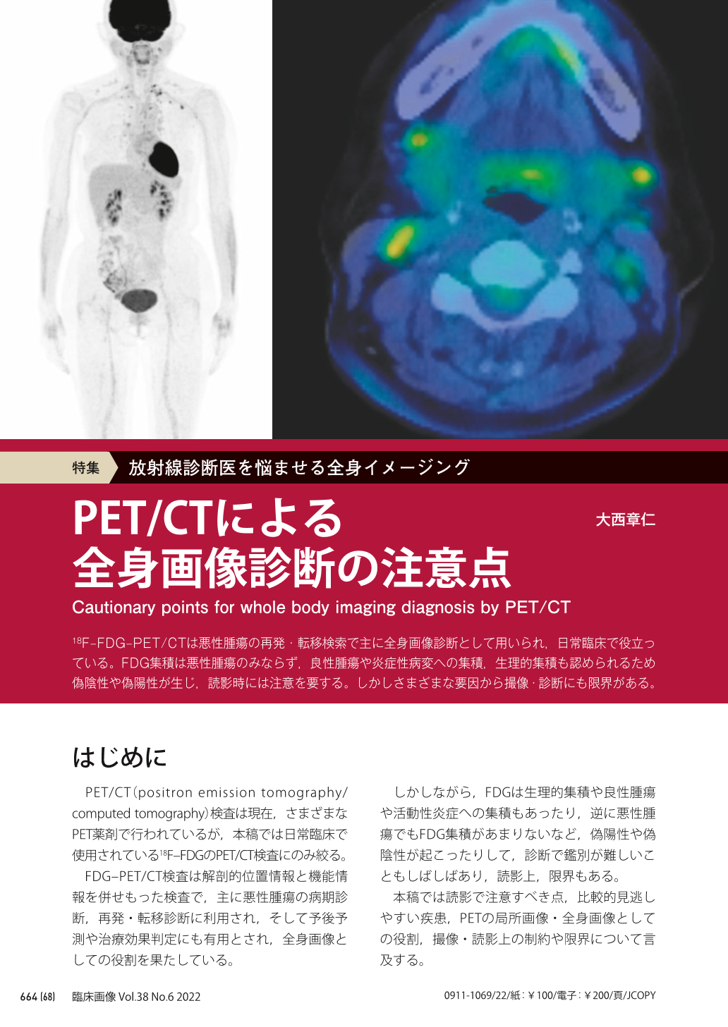 PET/CTによる全身画像診断の注意点 (臨床画像 38巻6号) | 医書.jp