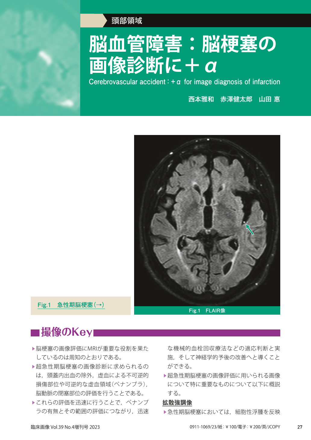 脳血管障害：脳梗塞の画像診断に＋α (臨床画像 39巻13号) | 医書.jp