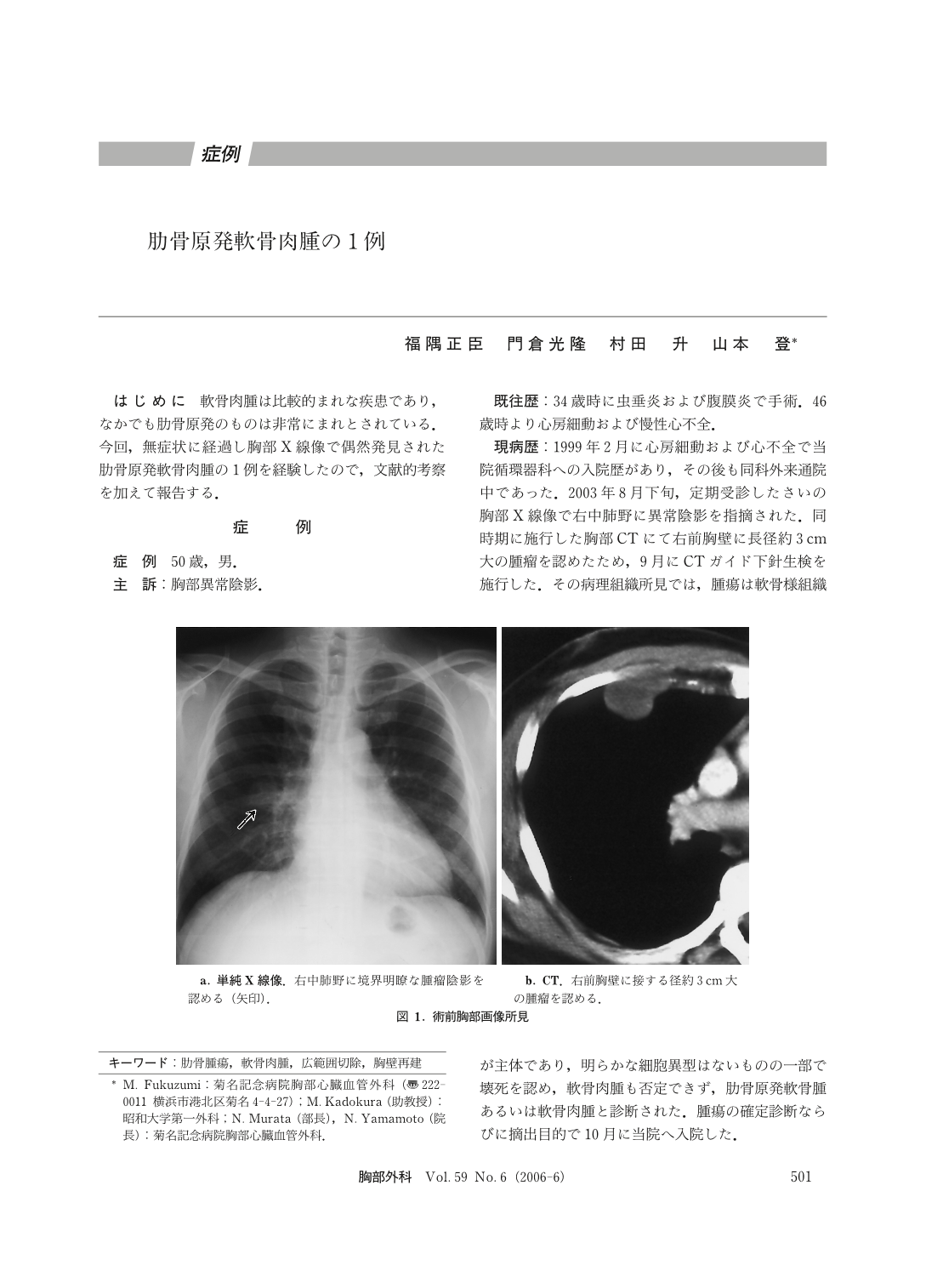 肋骨原発軟骨肉腫の1例 胸部外科 59巻6号 医書 Jp