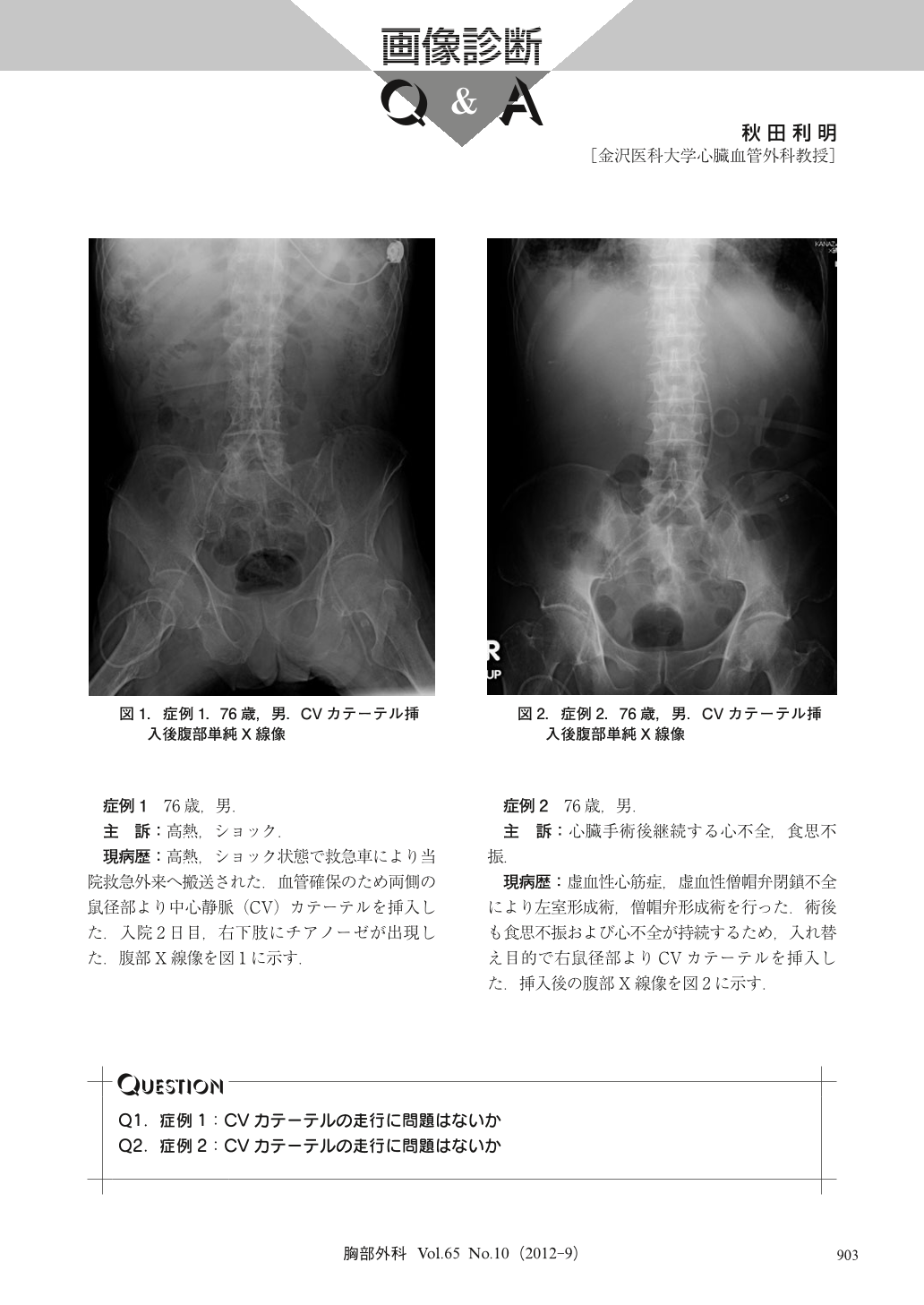 画像診断Q&A (胸部外科 65巻10号) | 医書.jp