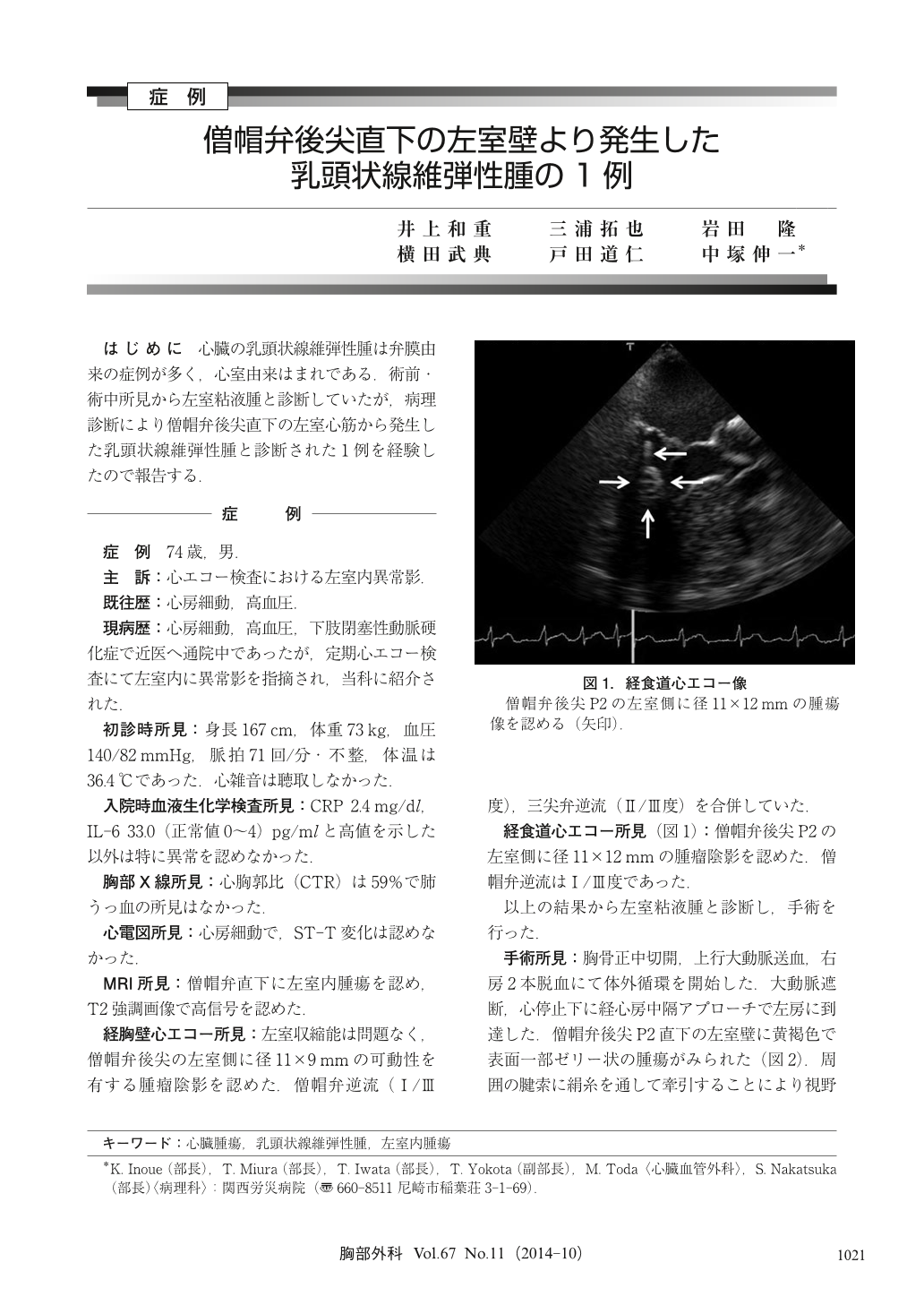 僧帽弁後尖直下の左室壁より発生した乳頭状線維弾性腫の1例 胸部外科 67巻11号 医書 Jp