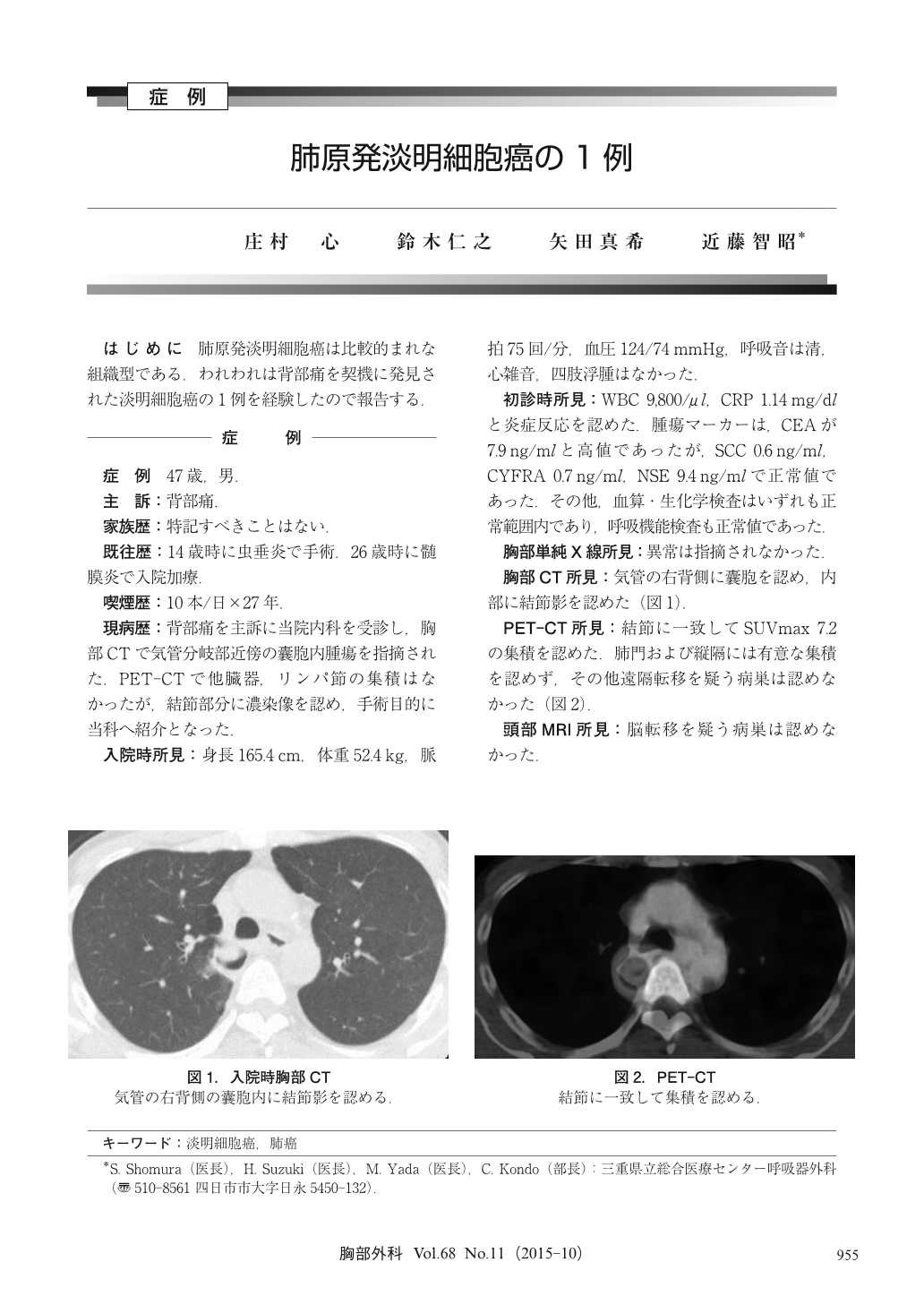 肺原発淡明細胞癌の1例 胸部外科 68巻11号 医書 Jp