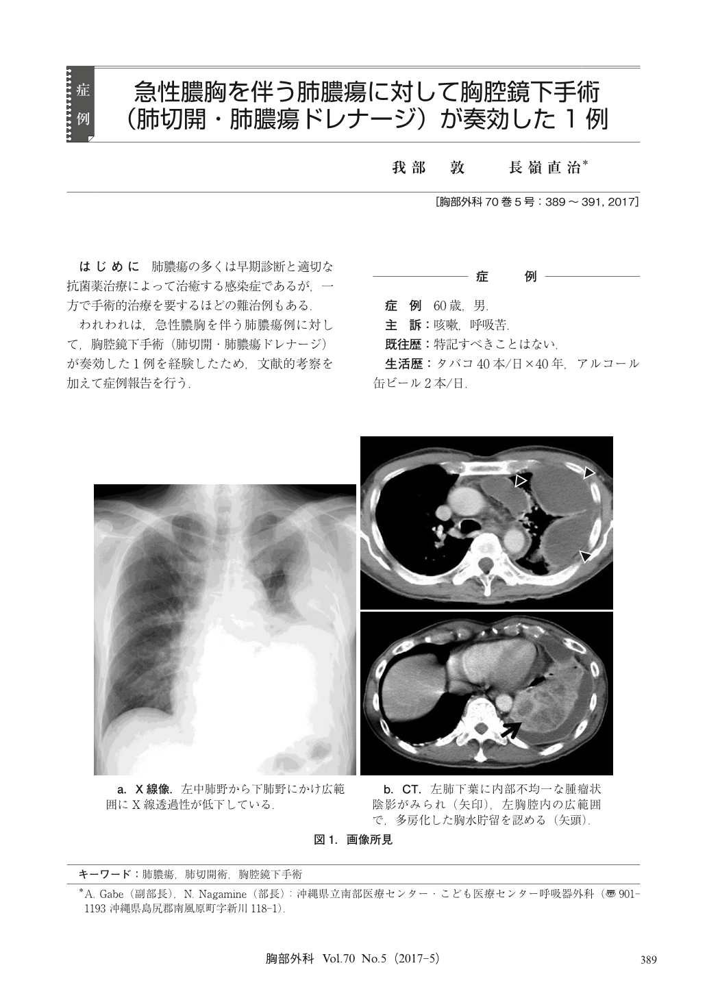 急性膿胸を伴う肺膿瘍に対して胸腔鏡下手術 肺切開 肺膿瘍ドレナージ が奏効した1例 胸部外科 70巻5号 医書 Jp