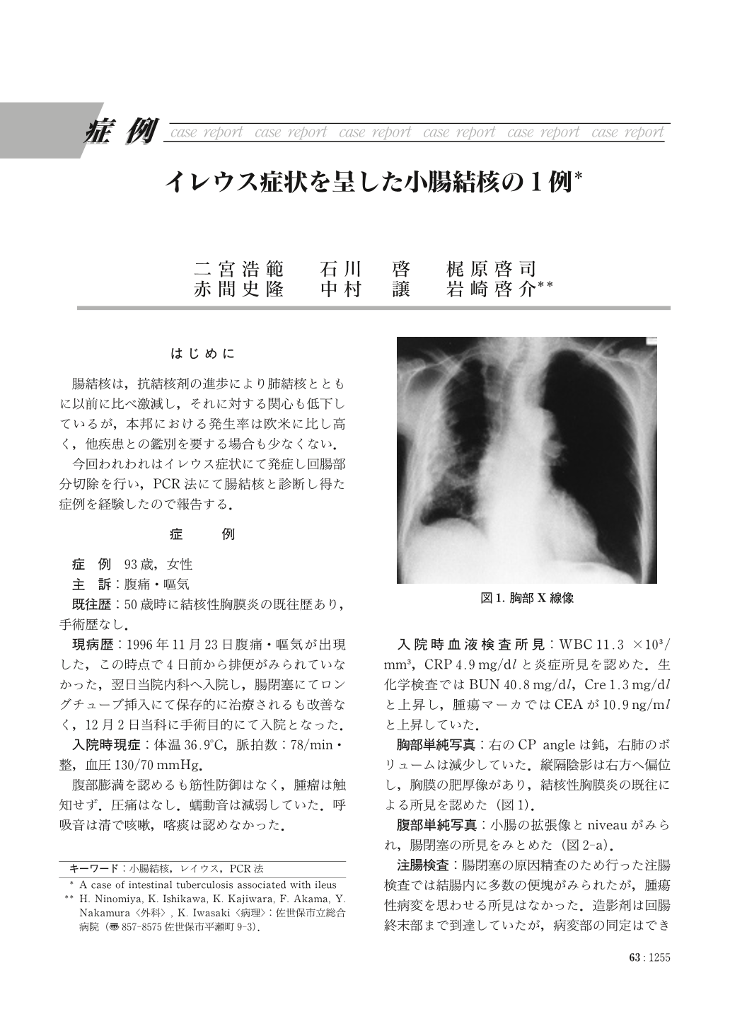 イレウス症状を呈した小腸結核の1例 臨床雑誌外科 63巻10号 医書 Jp