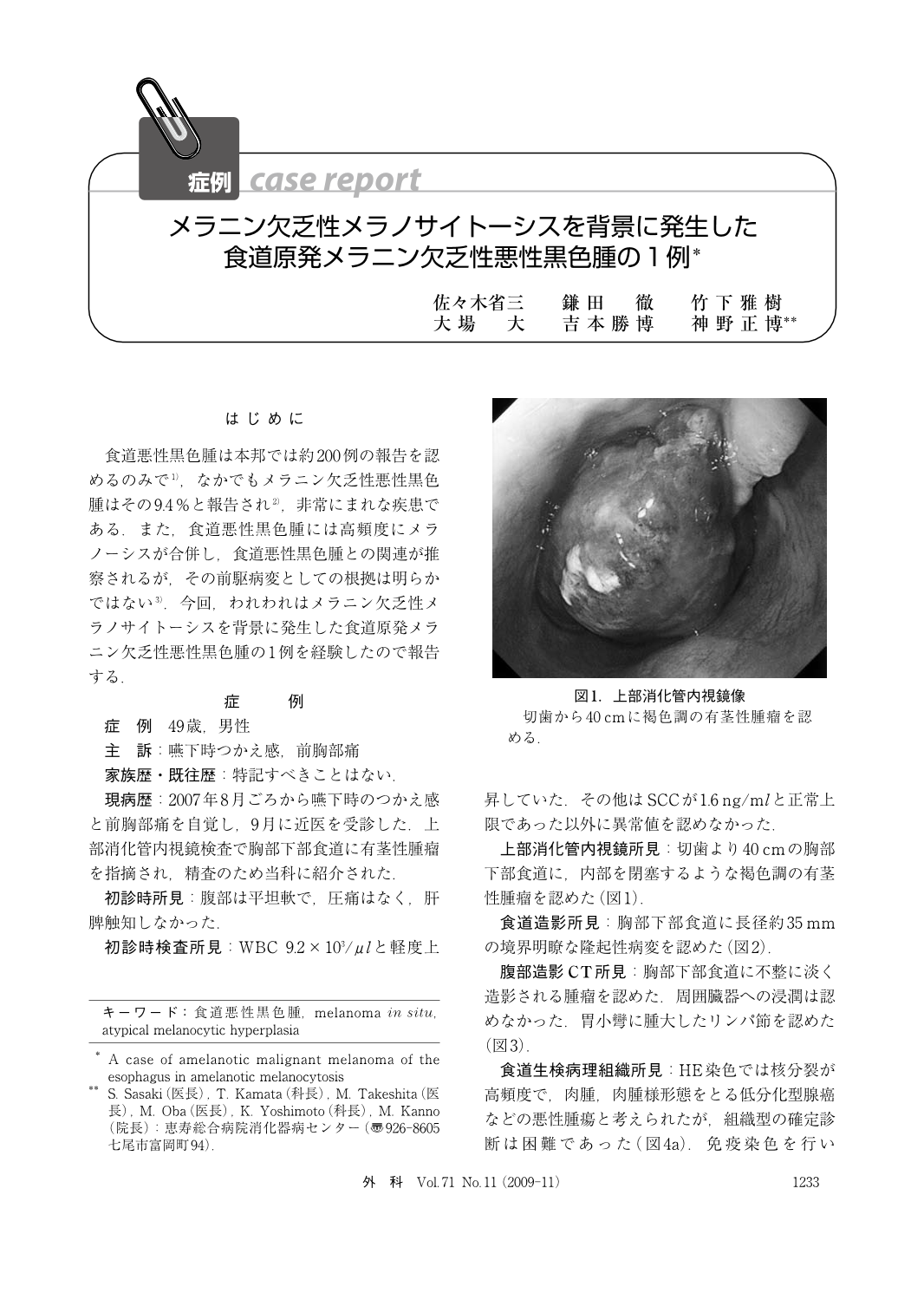 メラニン欠乏性メラノサイトーシスを背景に発生した食道原発メラニン欠乏性悪性黒色腫の1例 臨床雑誌外科 71巻11号 医書 Jp