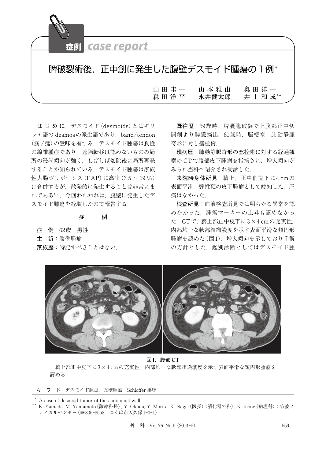 脾破裂術後 正中創に発生した腹壁デスモイド腫瘍の1例 臨床雑誌外科 76巻5号 医書 Jp