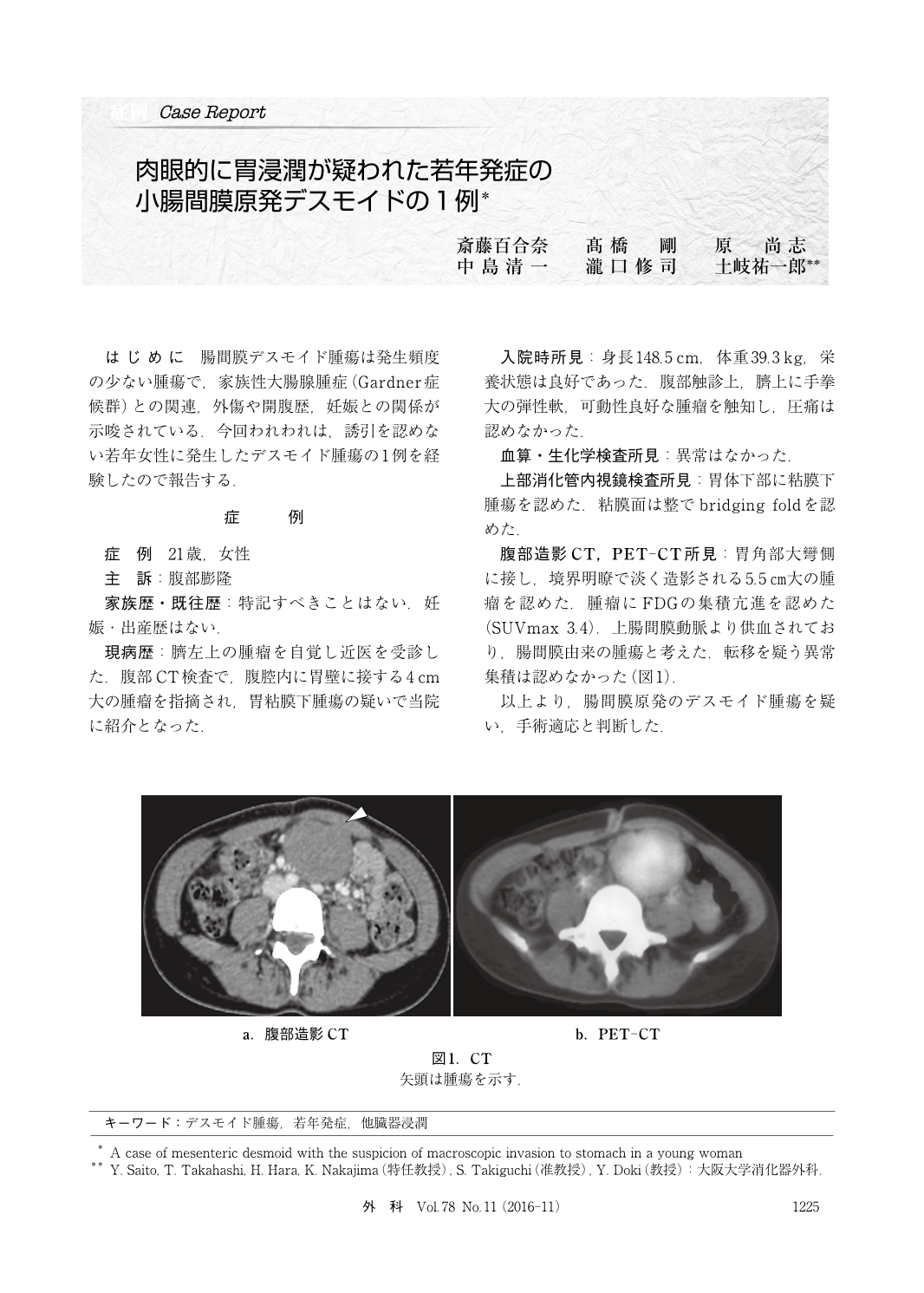 肉眼的に胃浸潤が疑われた若年発症の小腸間膜原発デスモイドの1例 臨床雑誌外科 78巻11号 医書 Jp