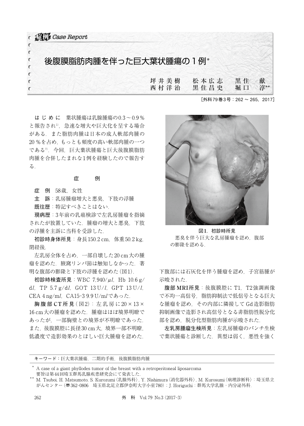 後腹膜脂肪肉腫を伴った巨大葉状腫瘍の1例 臨床雑誌外科 79巻3号 医書 Jp