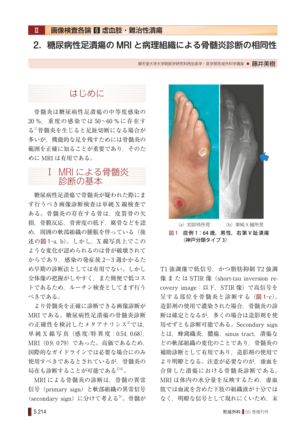 画像検査各論 虚血肢・難治性潰瘍 糖尿病性足潰瘍のMRIと病理組織