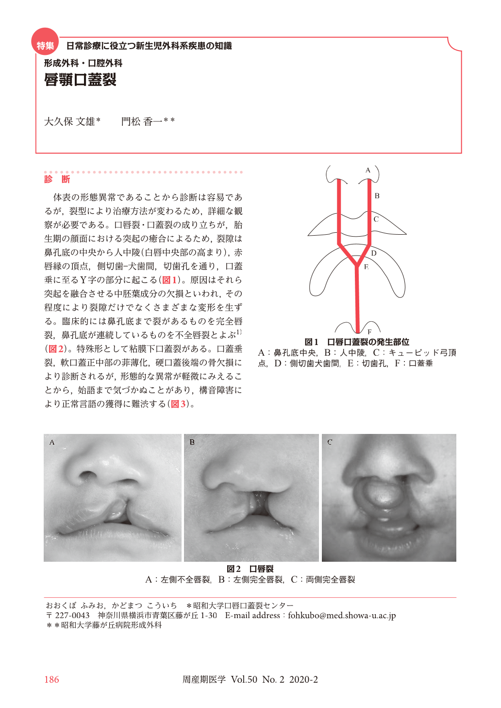 形成外科・口腔外科 唇顎口蓋裂 (周産期医学 50巻2号) | 医書.jp