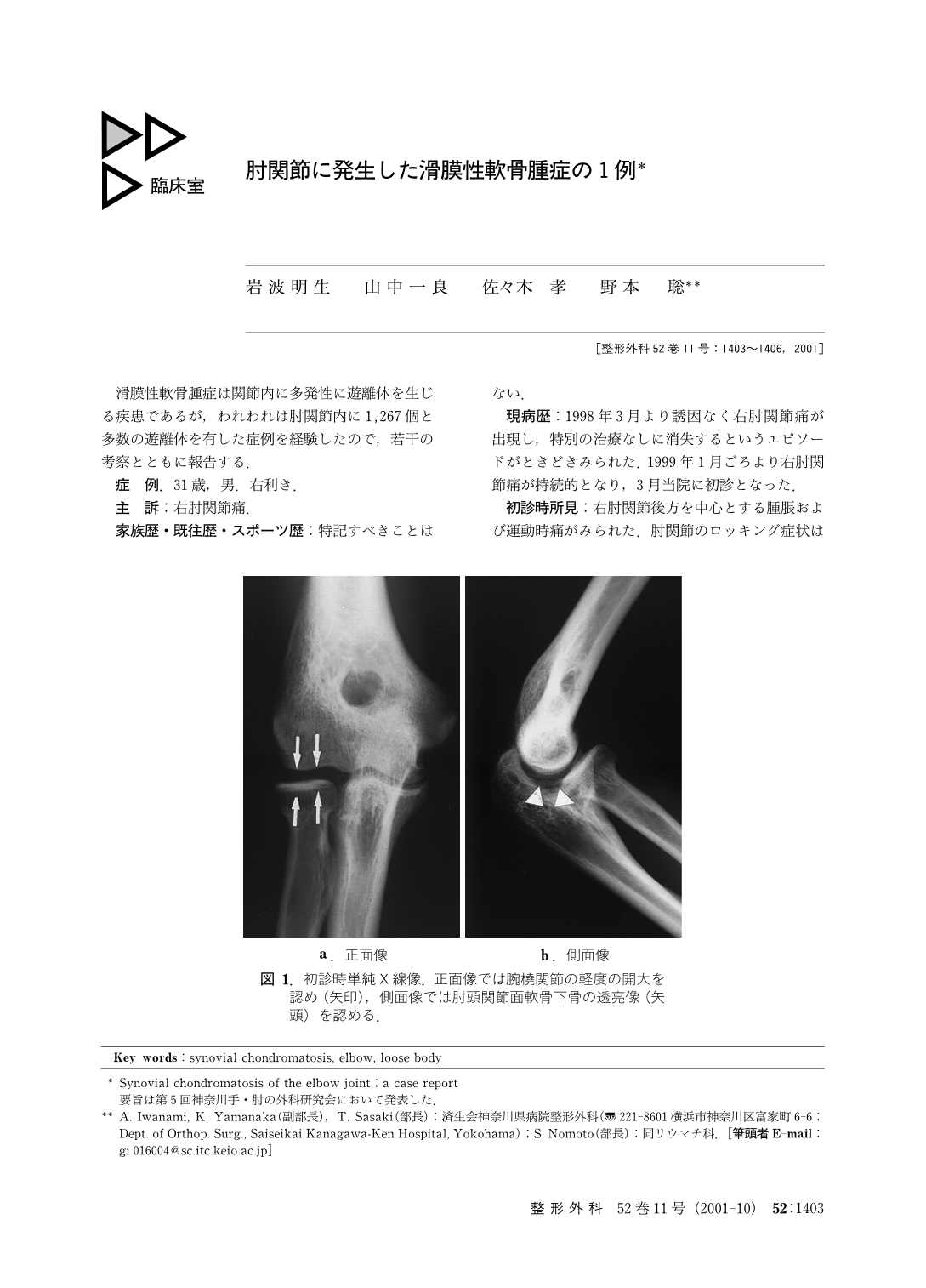 肘関節に発生した滑膜性軟骨腫症の1例 臨床雑誌整形外科 52巻11号 医書 Jp