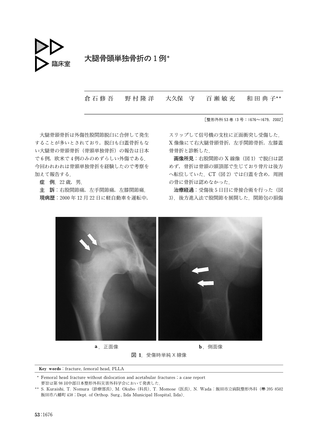 骨折の徒手整復実例集 - 健康/医学