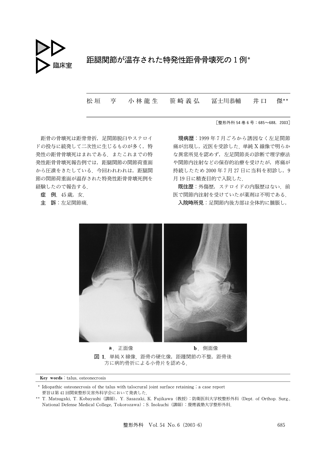 距腿関節が温存された特発性距骨骨壊死の1例 (臨床雑誌整形外科 54巻6 