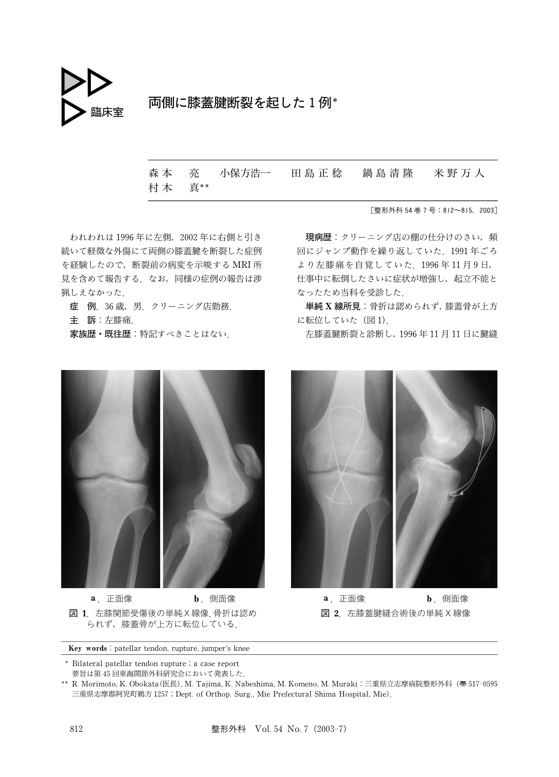両側に膝蓋腱断裂を起した1例 臨床雑誌整形外科 54巻7号 医書 Jp