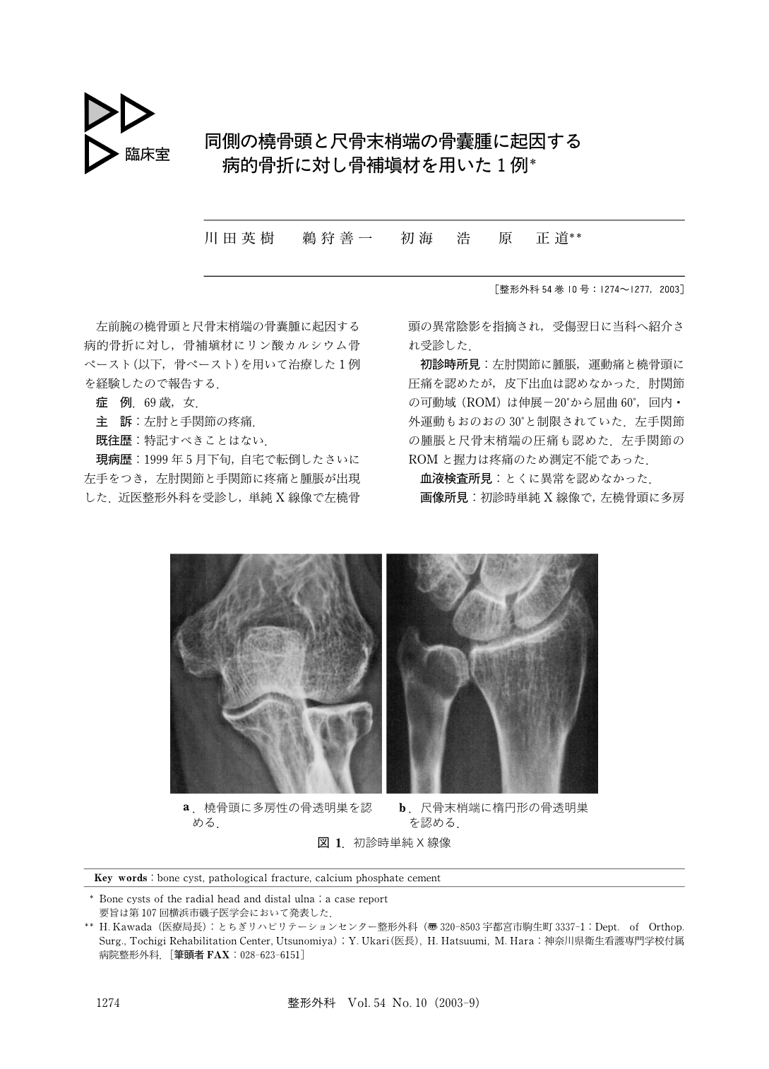 同側の橈骨頭と尺骨末梢端の骨嚢腫に起因する病的骨折に対し骨補填材を用いた1例 臨床雑誌整形外科 54巻10号 医書 Jp