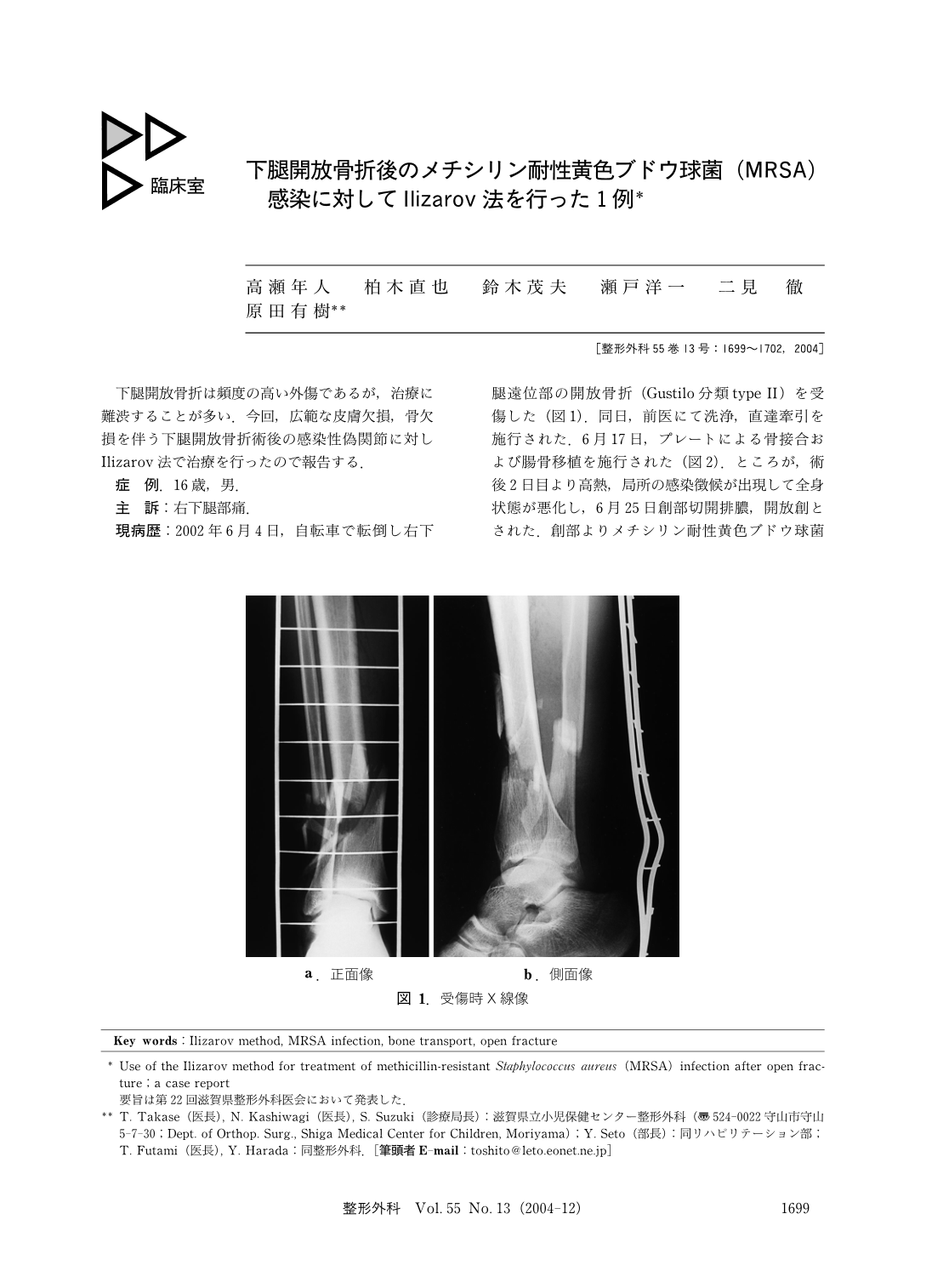 下腿開放骨折後のメチシリン耐性黄色ブドウ球菌 Mrsa 感染に対してilizarov法を行った1例 臨床雑誌整形外科 55巻13号 医書 Jp