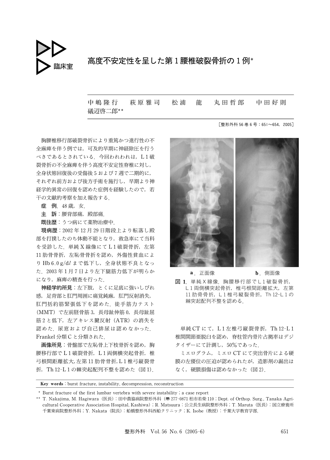 高度不安定性を呈した第1腰椎破裂骨折の1例 臨床雑誌整形外科 56巻6号 医書 Jp