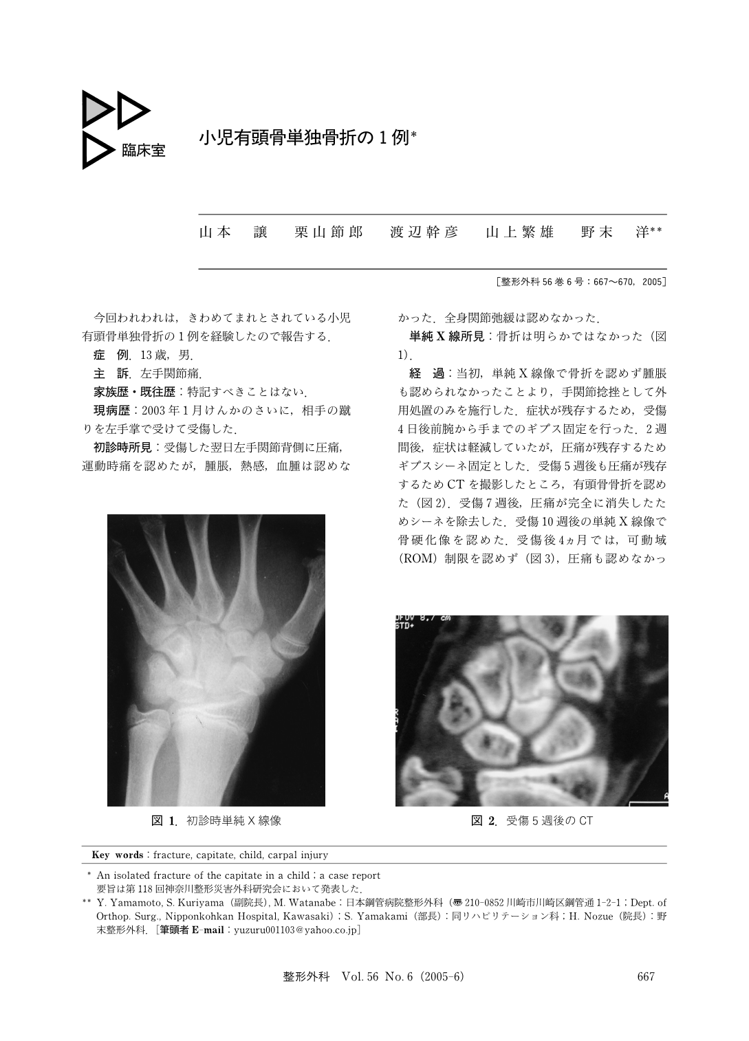 小児有頭骨単独骨折の1例 臨床雑誌整形外科 56巻6号 医書 Jp