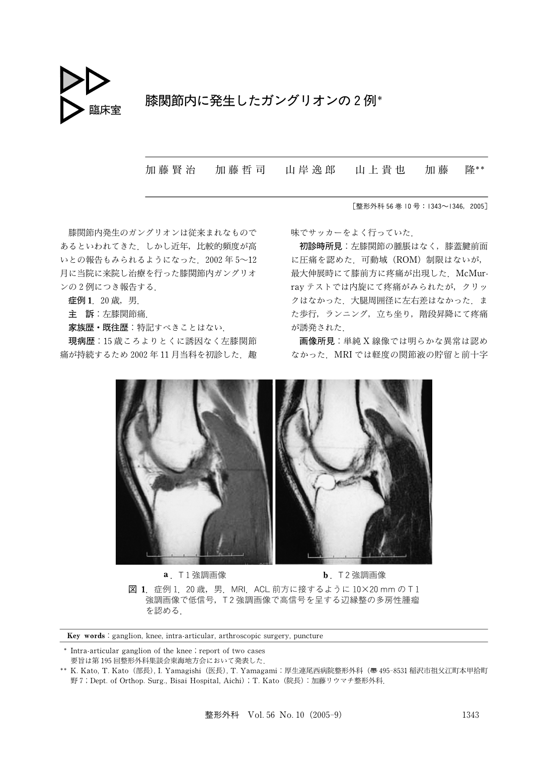 膝関節内に発生したガングリオンの2例 臨床雑誌整形外科 56巻10号 医書 Jp