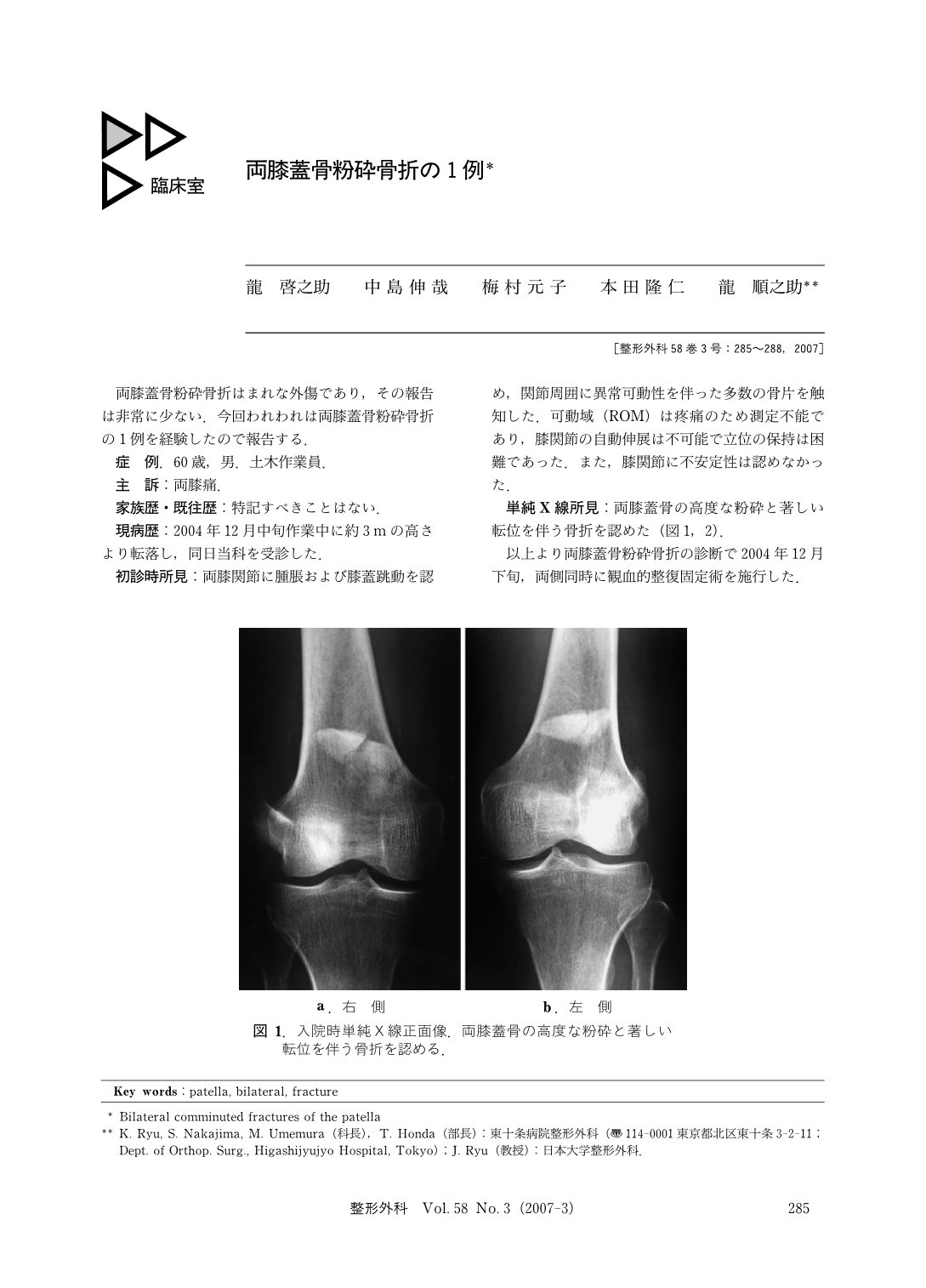 両膝蓋骨粉砕骨折の1例 臨床雑誌整形外科 58巻3号 医書 Jp