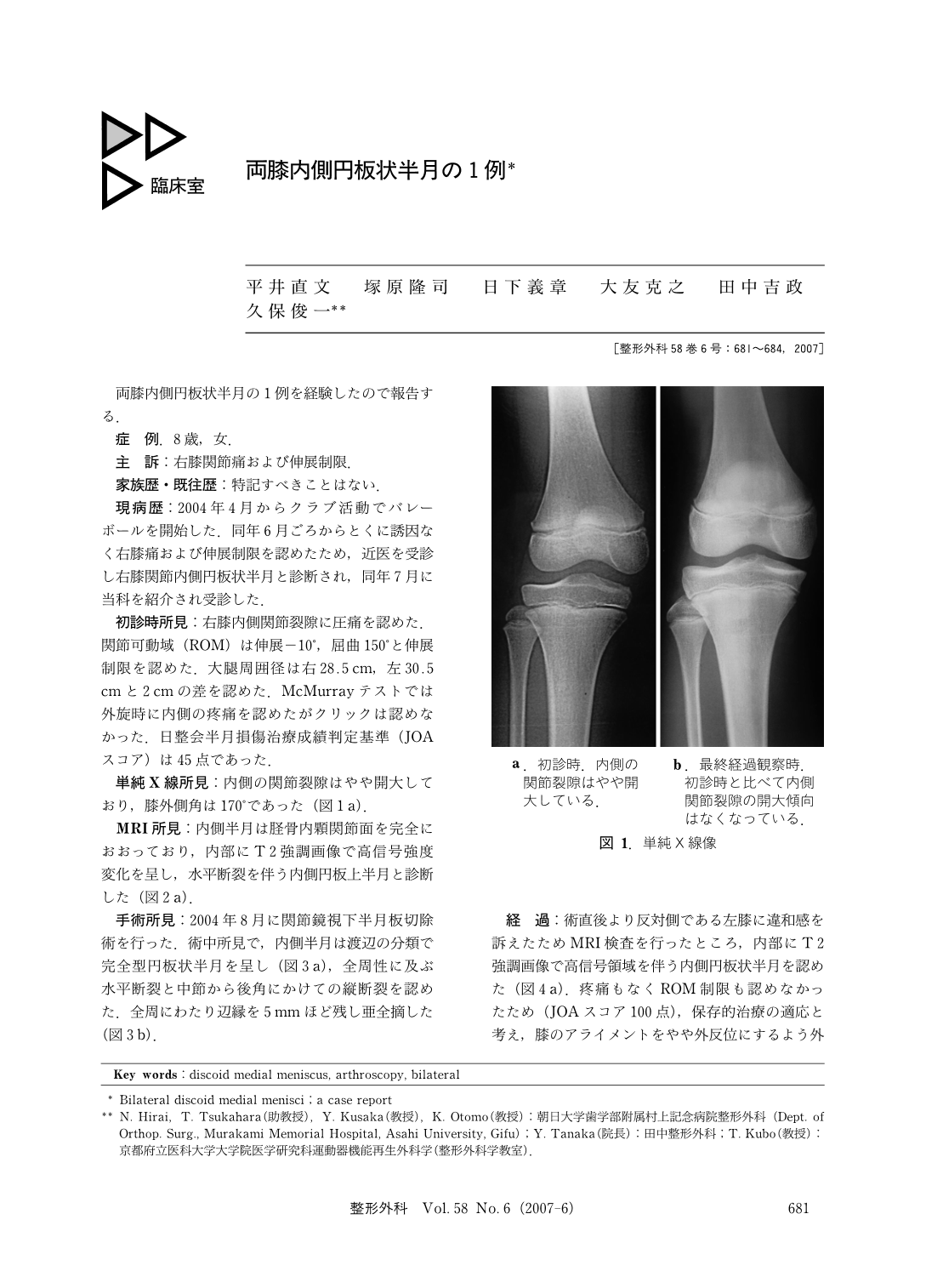 両膝内側円板状半月の1例 臨床雑誌整形外科 58巻6号 医書 Jp
