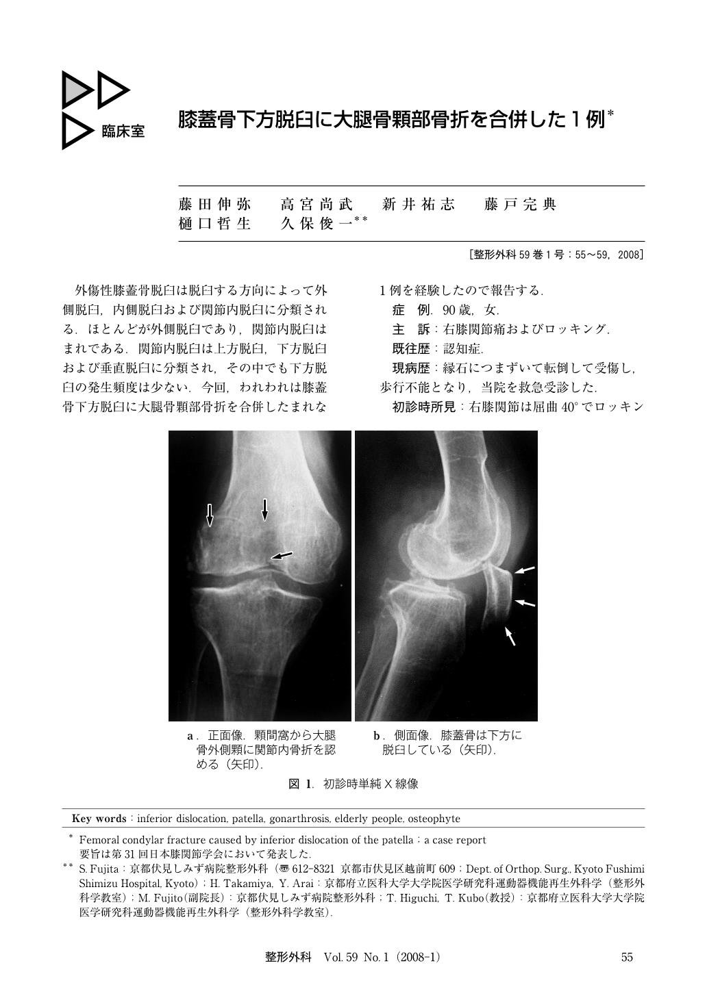 膝蓋骨下方脱臼に大腿骨顆部骨折を合併した1例 臨床雑誌整形外科 59巻1号 医書 Jp