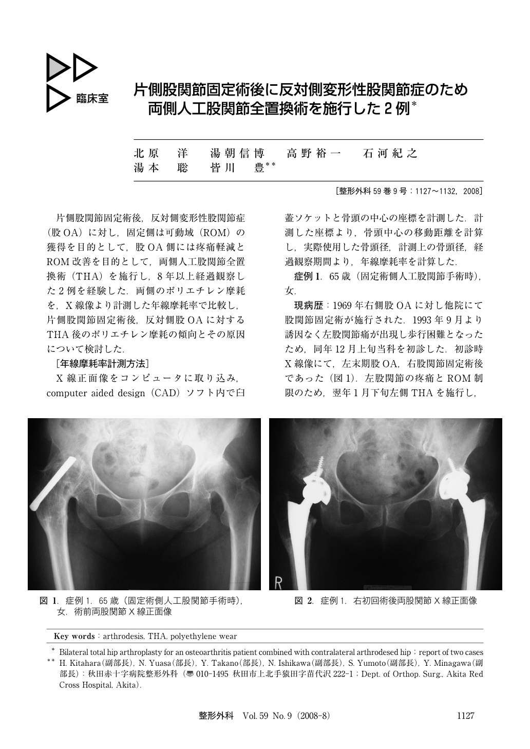 JLC ** 変形性膝関節症に対する人工膝関節置換術後の理学療法 ...
