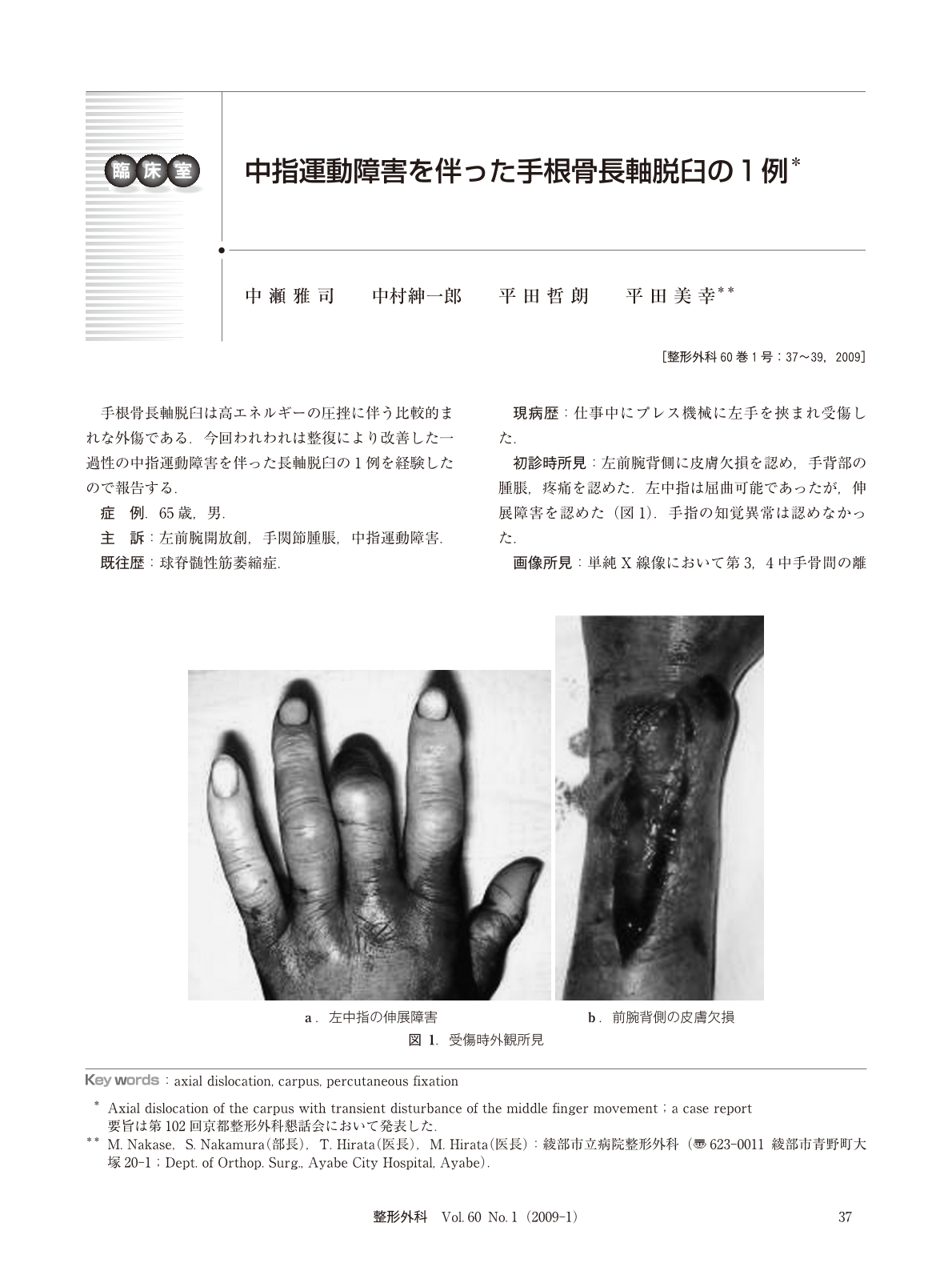 中指運動障害を伴った手根骨長軸脱臼の1例 臨床雑誌整形外科 60巻1号 医書 Jp