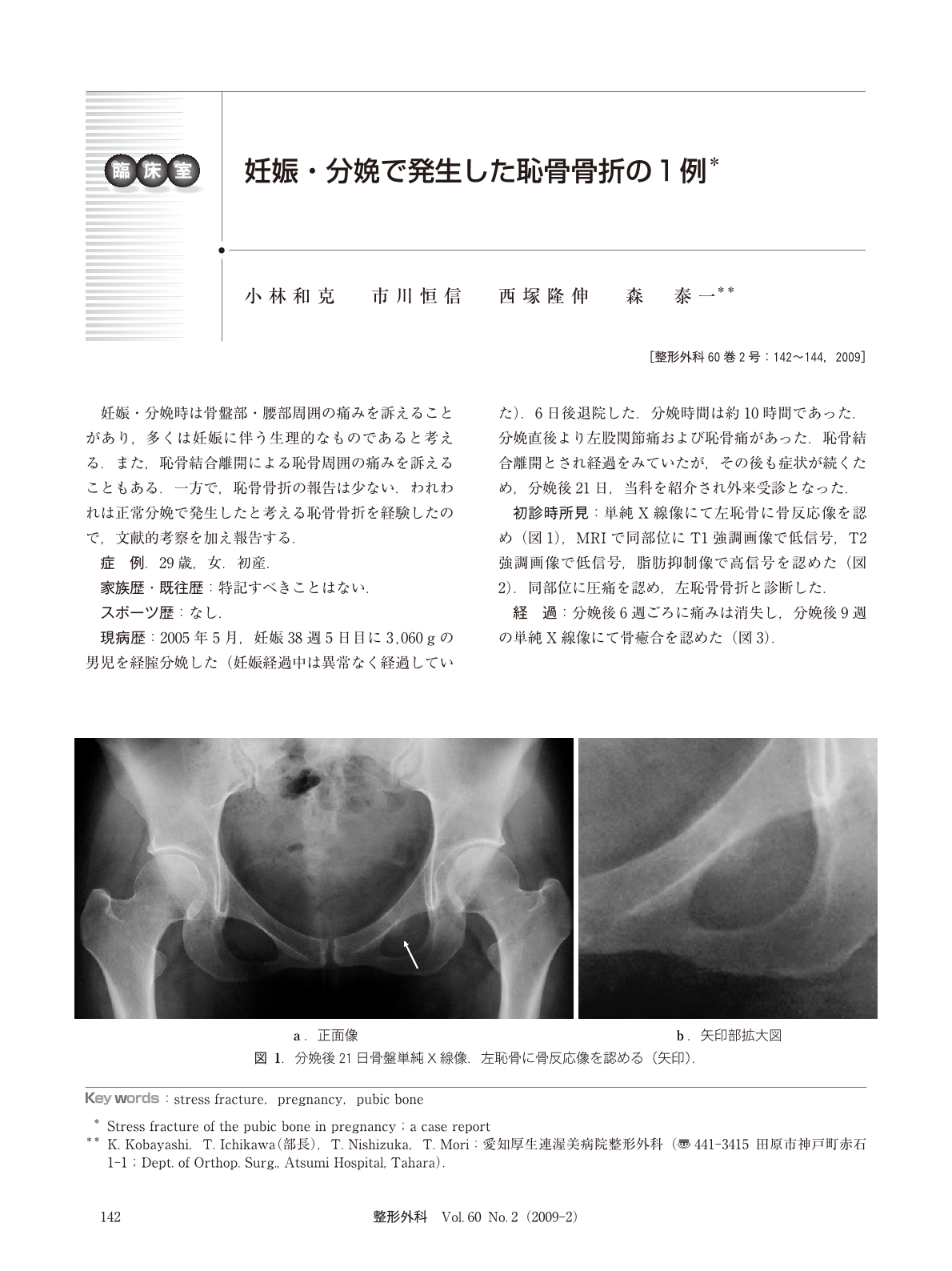 妊娠 分娩で発生した恥骨骨折の1例 臨床雑誌整形外科 60巻2号 医書 Jp