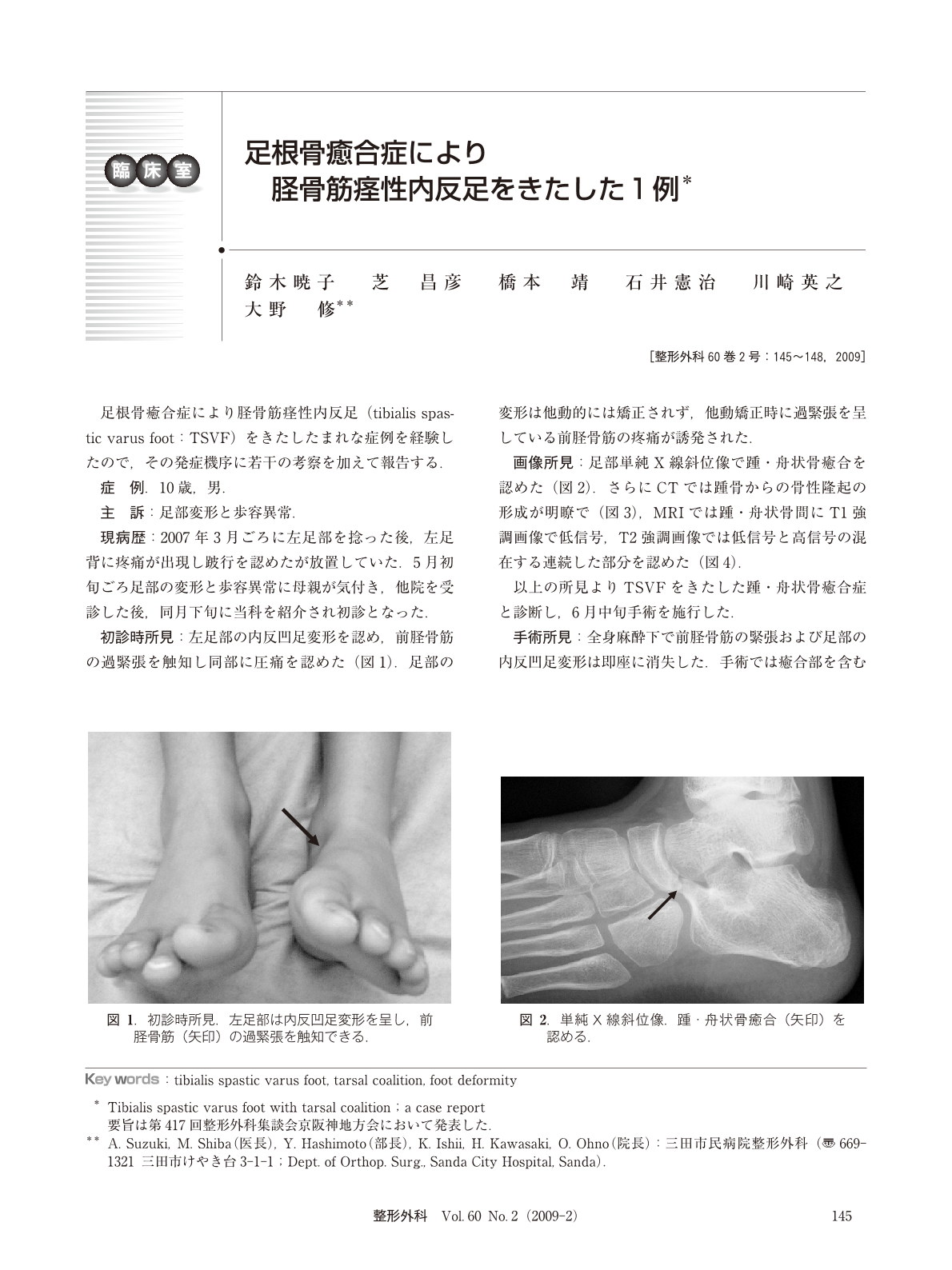 足根骨癒合症により脛骨筋痙性内反足をきたした1例 臨床雑誌整形外科 60巻2号 医書 Jp