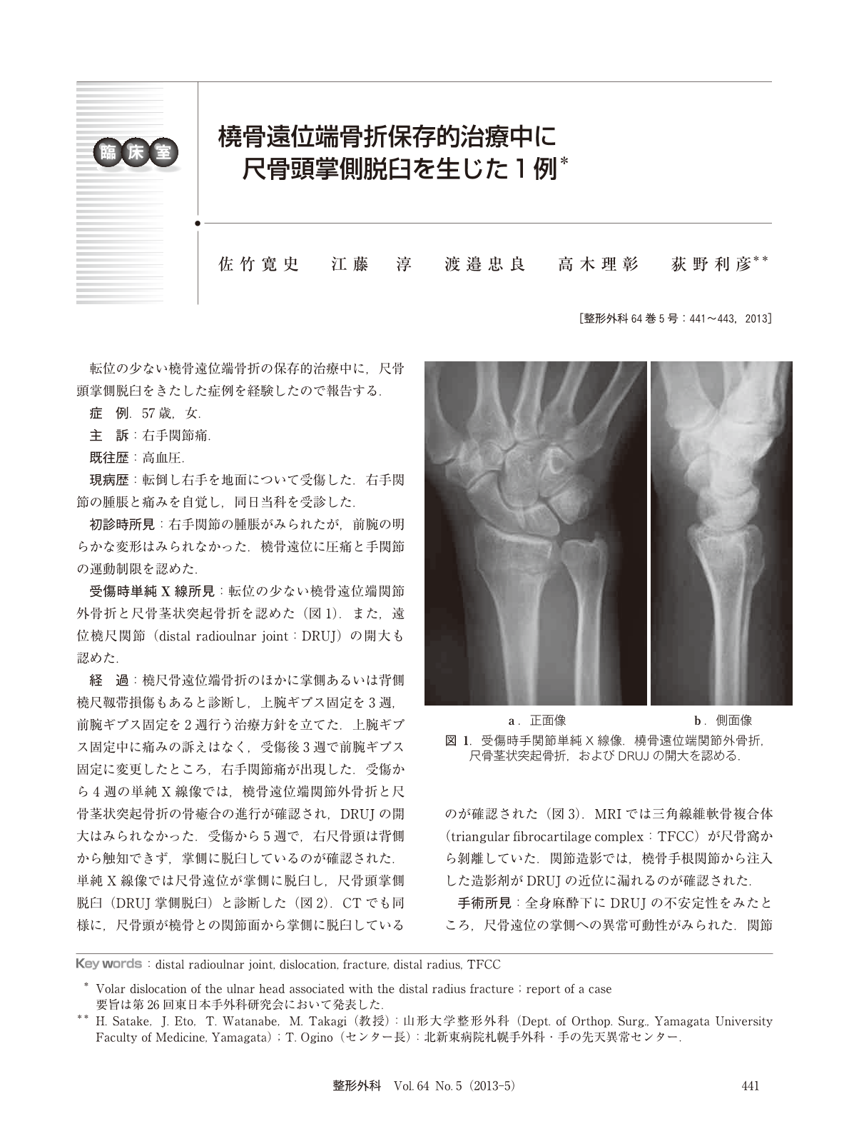 橈骨遠位端骨折保存的治療中に尺骨頭掌側脱臼を生じた1例 臨床雑誌整形外科 64巻5号 医書 Jp