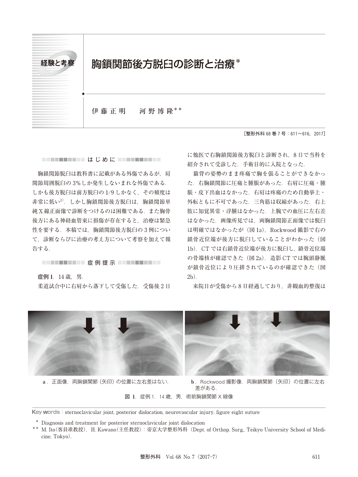 胸鎖関節後方脱臼の診断と治療 臨床雑誌整形外科 68巻7号 医書 Jp