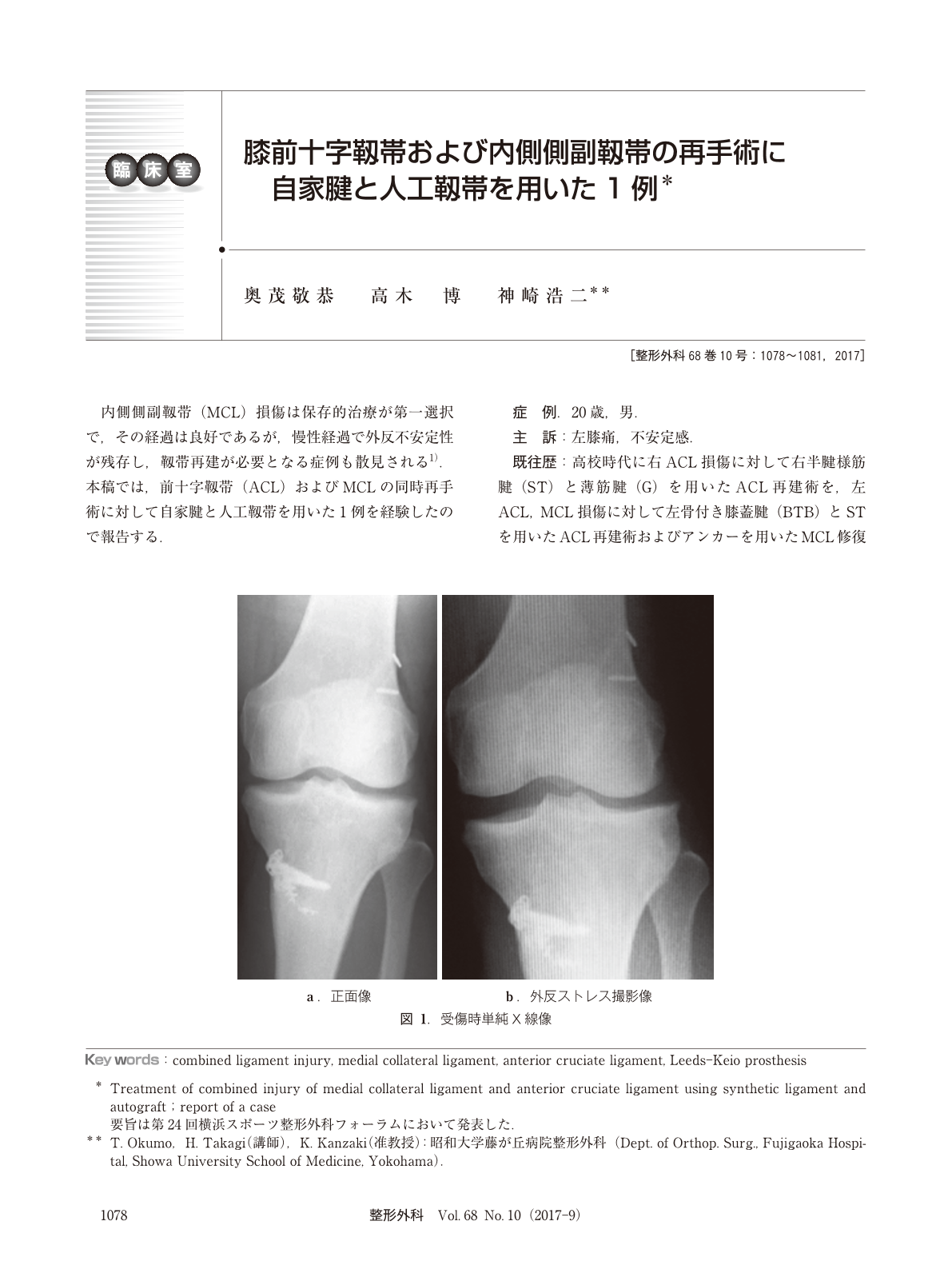 膝前十字靱帯および内側側副靱帯の再手術に自家腱と人工靱帯を用いた1例 臨床雑誌整形外科 68巻10号 医書 Jp